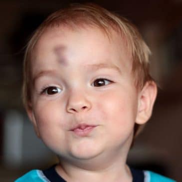 kid injury face