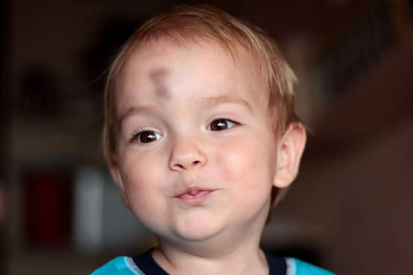 kid injury face