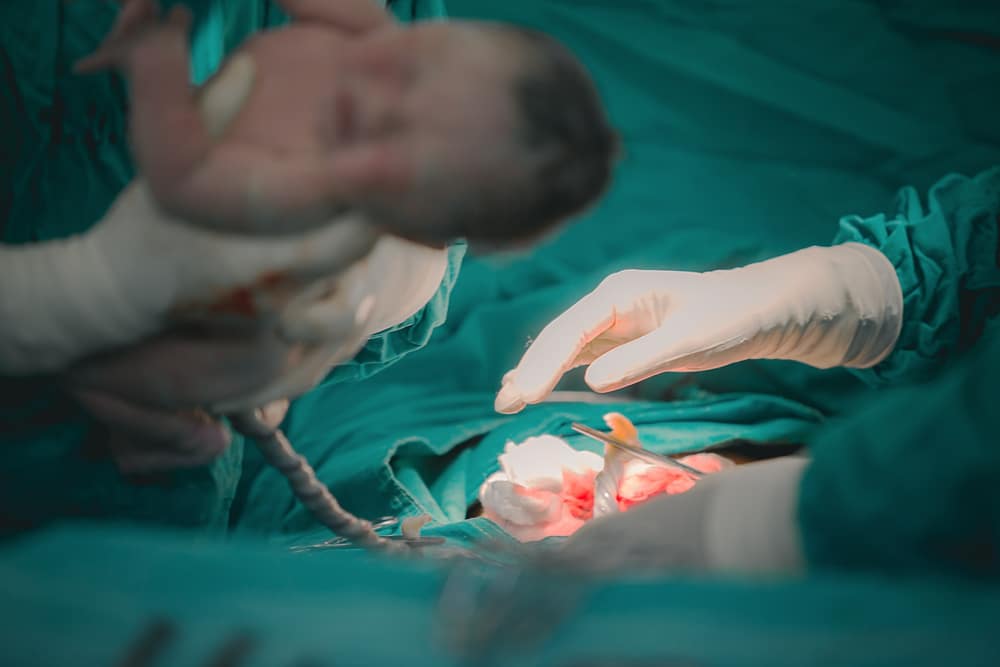 caesarean woman and baby